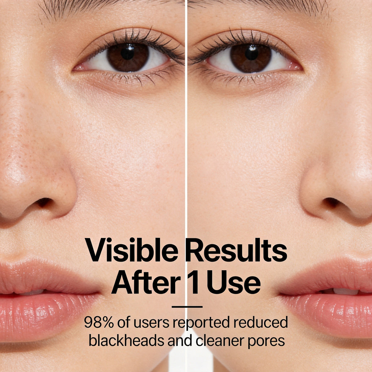 Nasal Blackhead Remover Mask - Gentle Brightening & Skin Soothing 30g