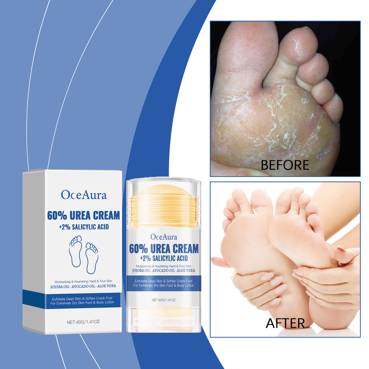 Moisturizing Anti-Crack Foot Cream 40g