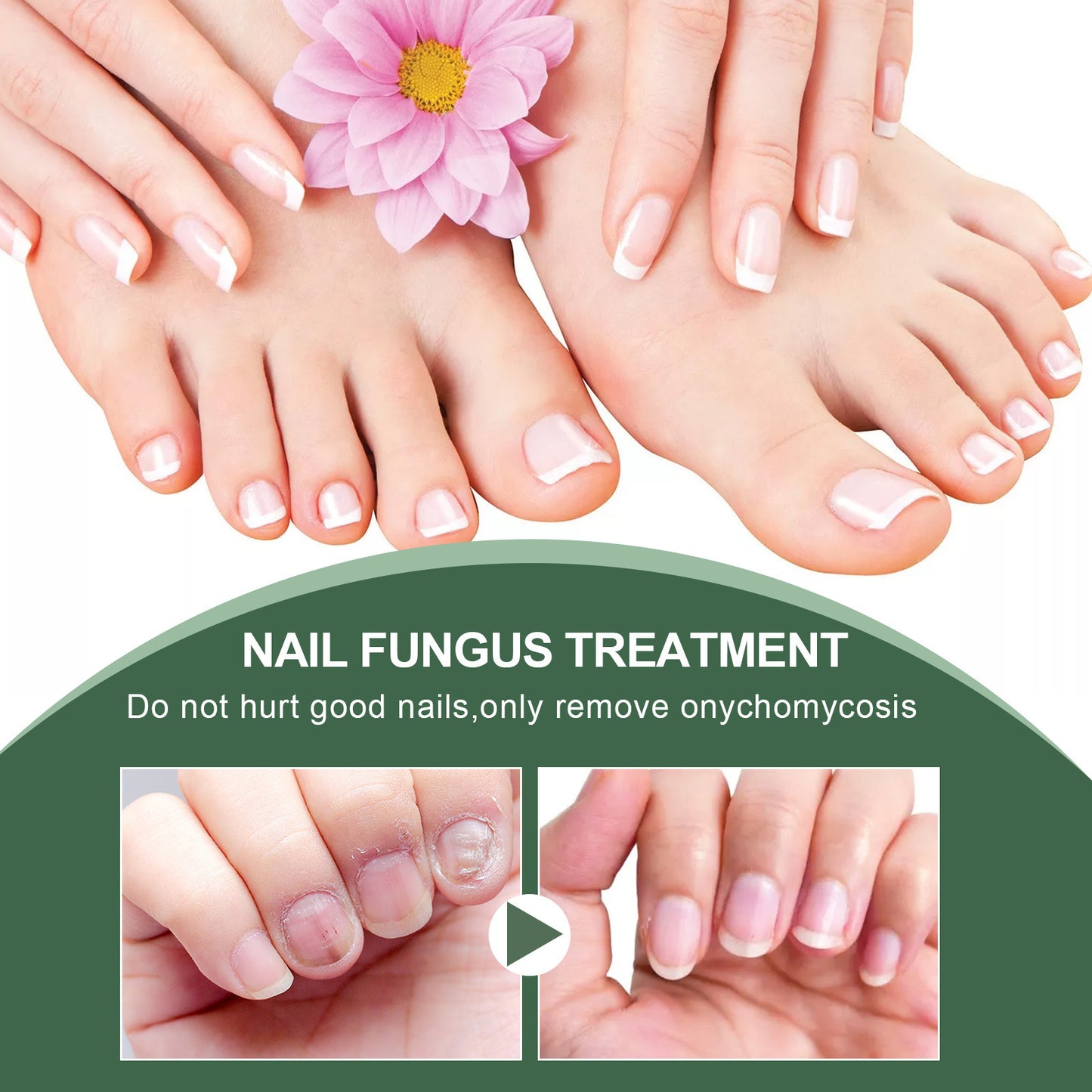 Nail Care Liquid for Cleaning Fingernails and Toenails - 30ml & 50ml Options