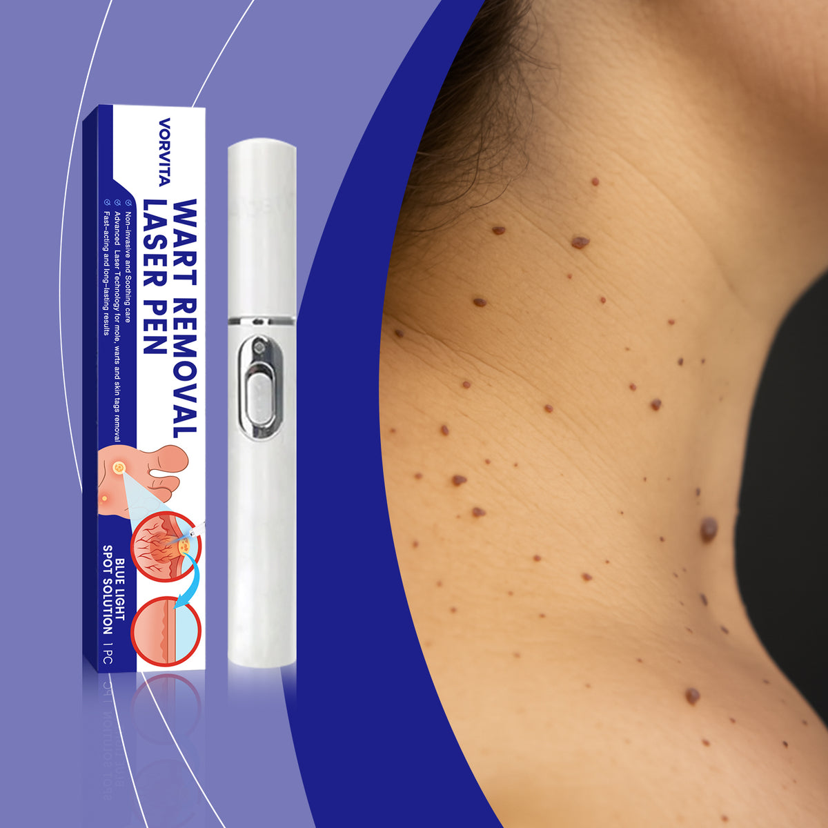 Face Skin Care Laser Pen - Anti-Aging Skin Treatment Tool