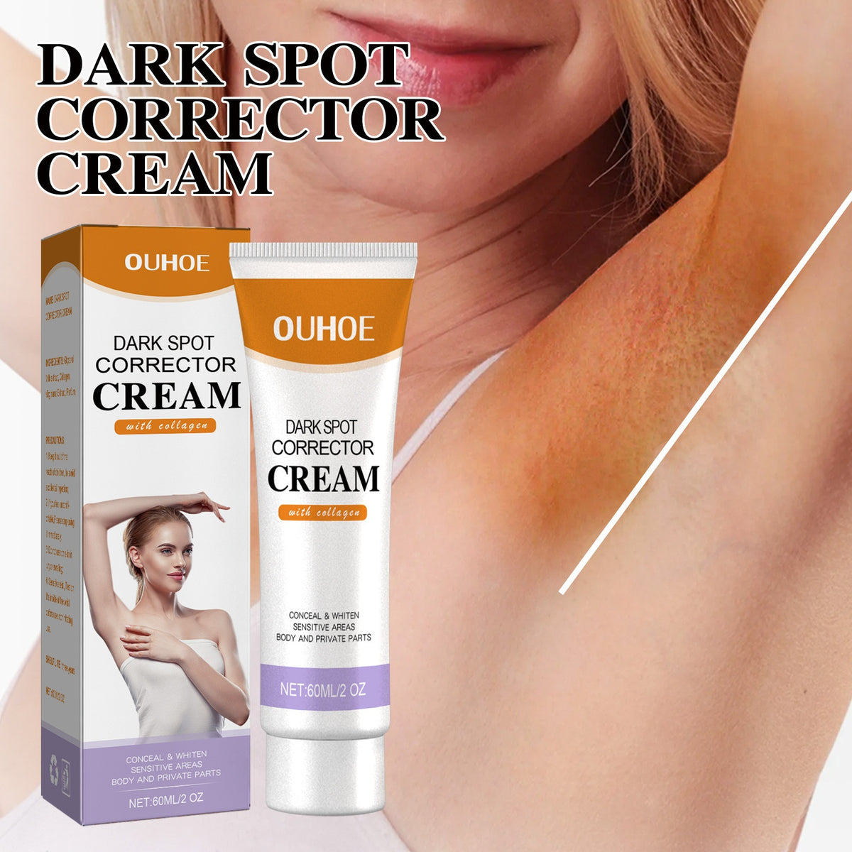 Black Spot Fade Cream 60ml – Brighten Skin
