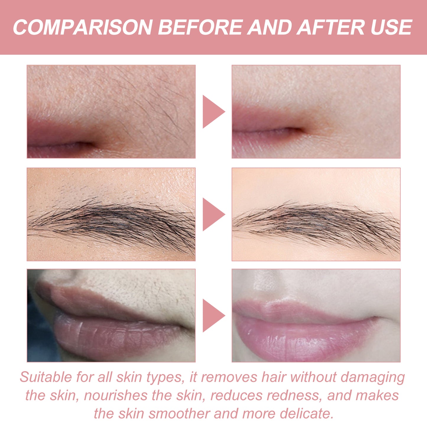 Peach Gentle Hair Removal Cream - Fast-Acting Depilatory for Face & Body