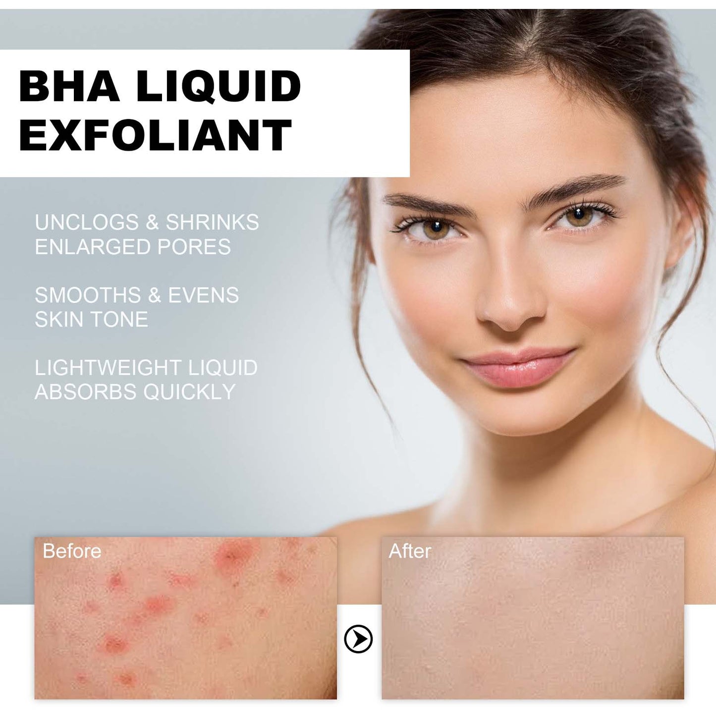 BHA Liquid Exfoliant - Pore-Tightening Facial Essence & Acne Treatment