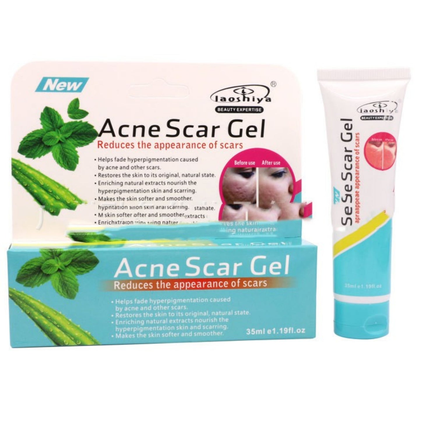 Acne Removal Cream with Green Tea & Aloe Vera 35ml - Oil Control & Pore Tightening