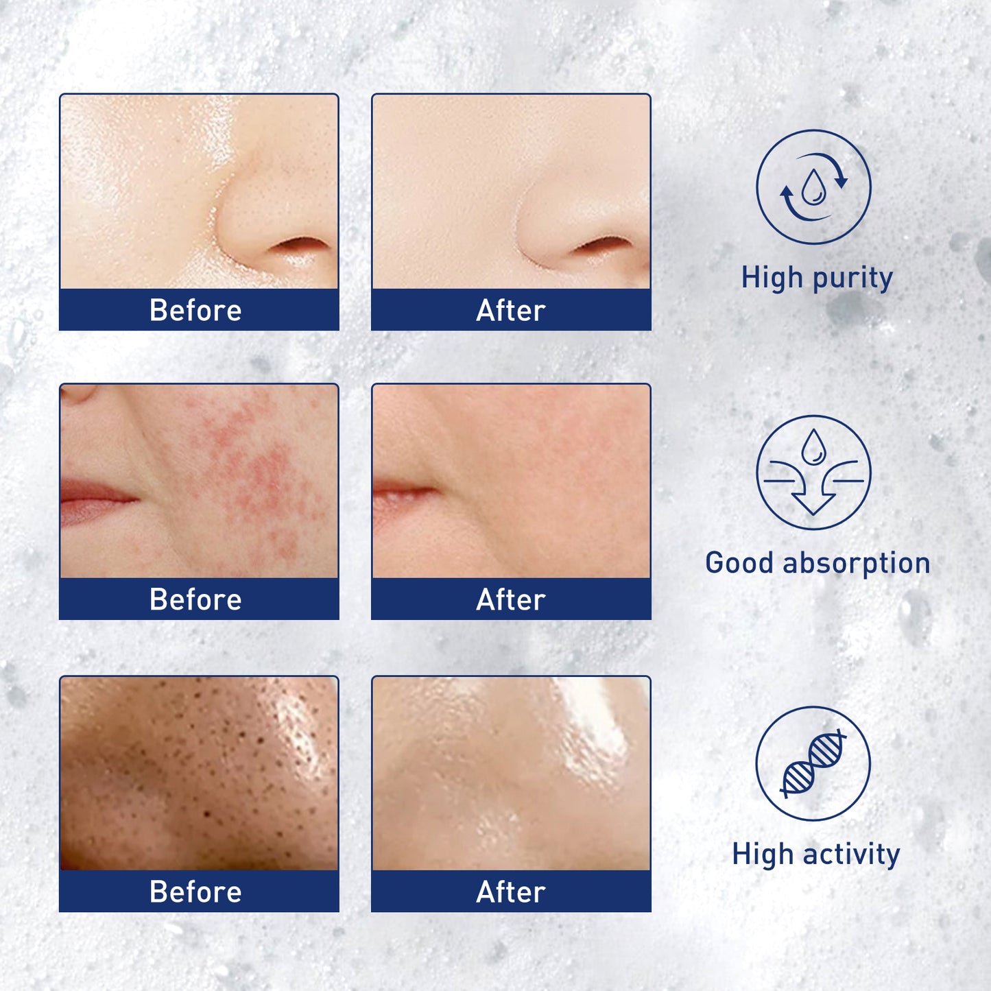 Exfoliating Facial Mousse - Deep Pore Cleansing & Oil Control Foam