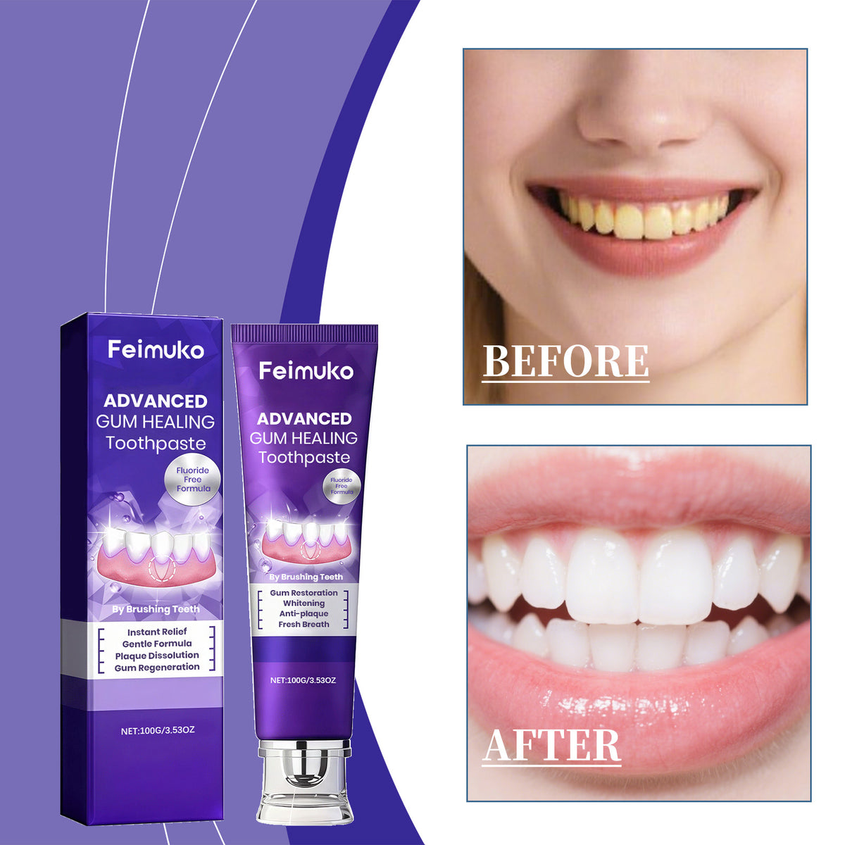 Whitening Toothpaste with Gum Care – 100g