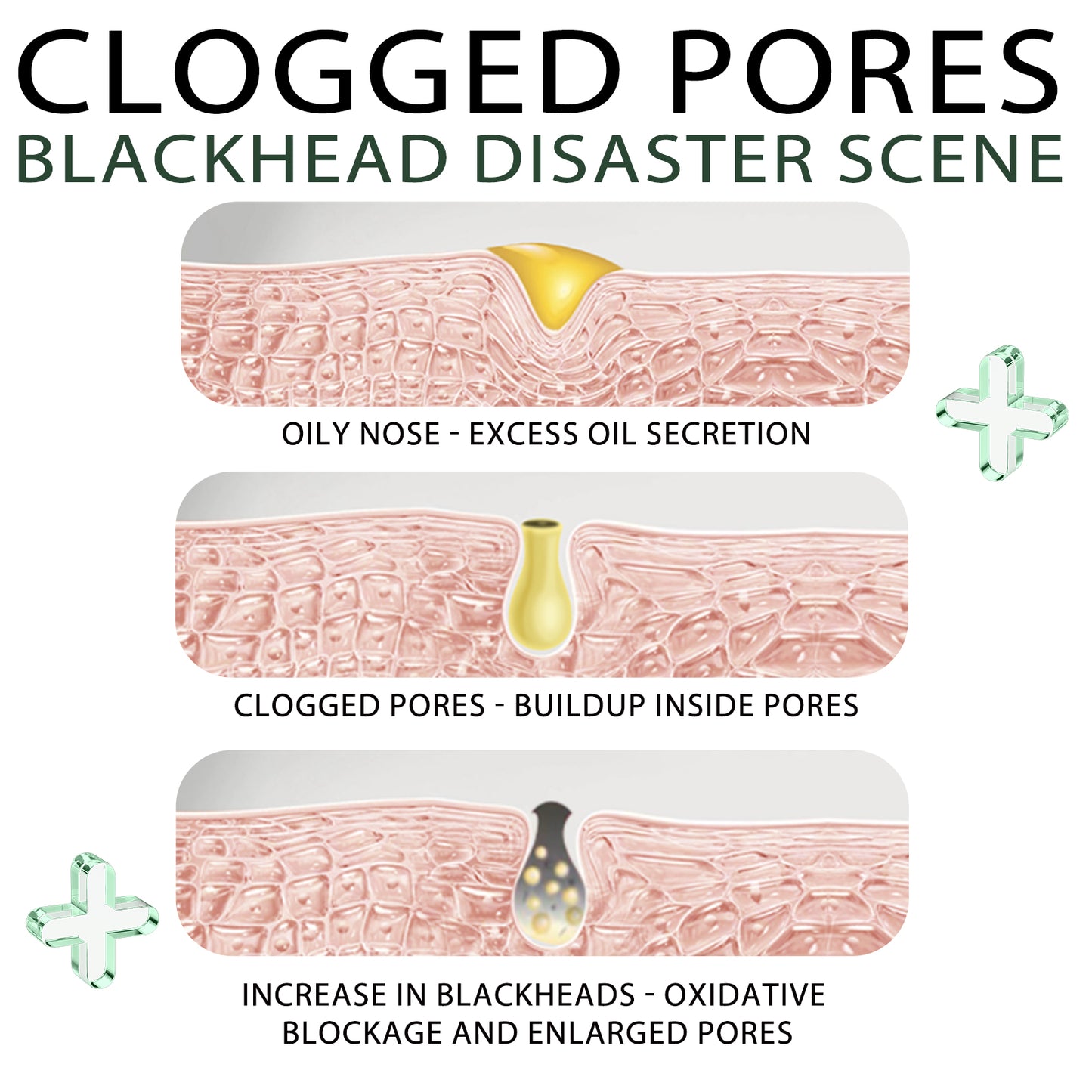 Blackhead Remover Cream Kit with 40 Pore Strips for Deep Pore Cleansing