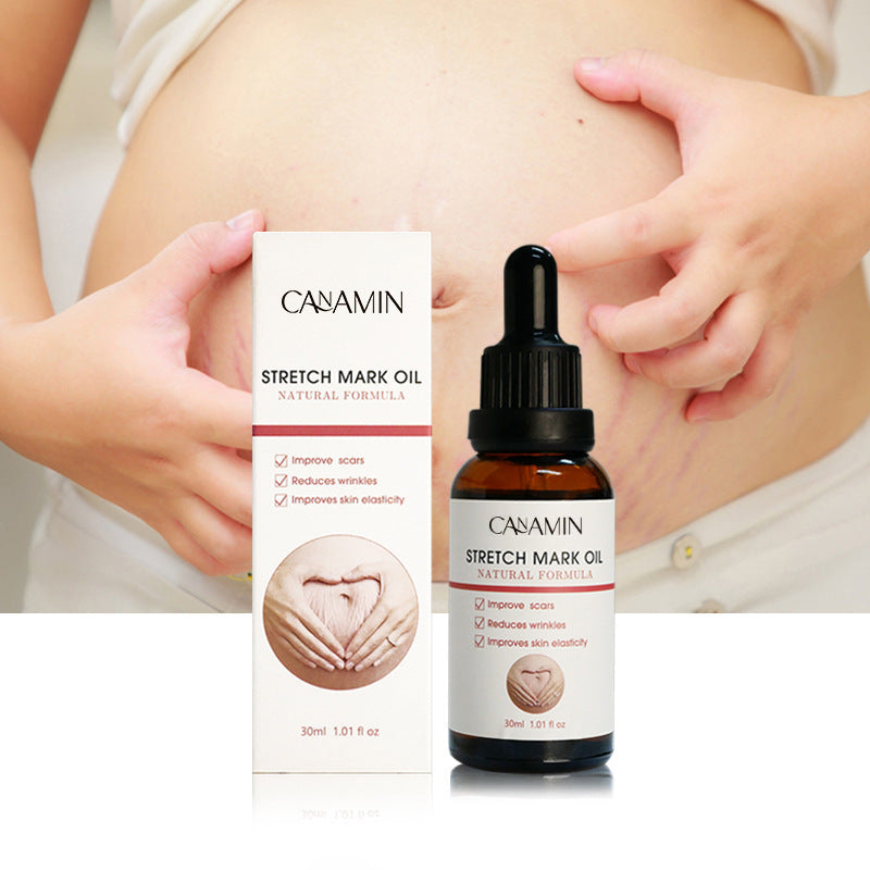 Stretch Mark Oil – 30ml Body Care Serum