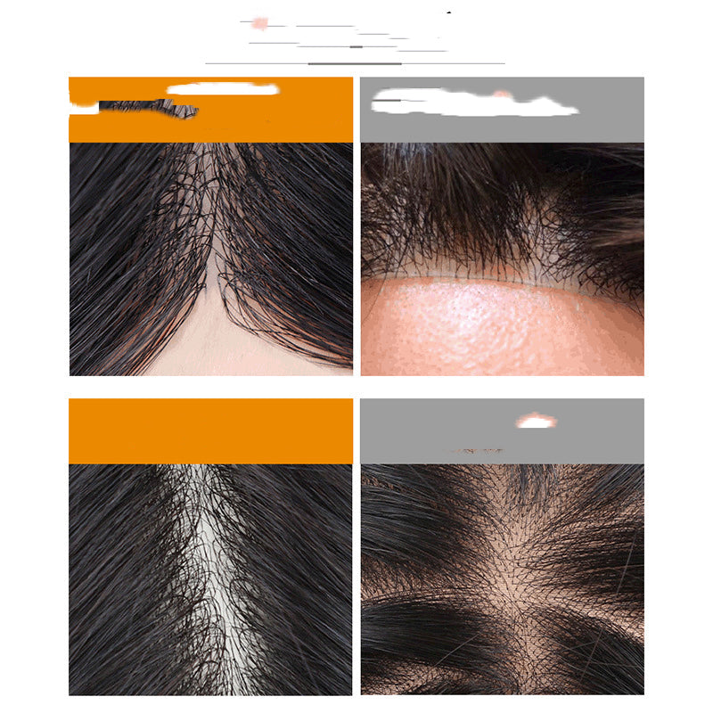 Breathable Bio Scalp Hair Replacement Wig for Men - Natural Color, Short Length