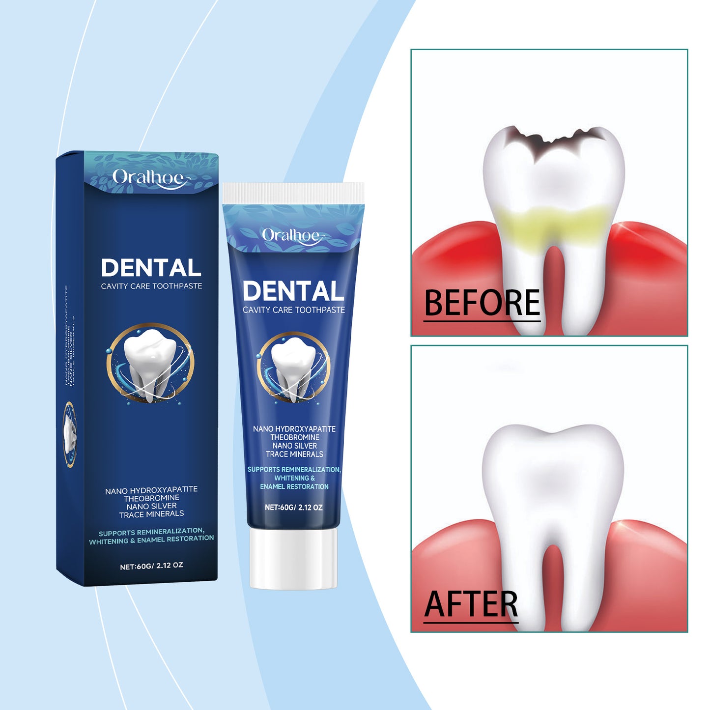Dental Care Toothpaste 60g - Enamel Repair & Antibacterial Protection