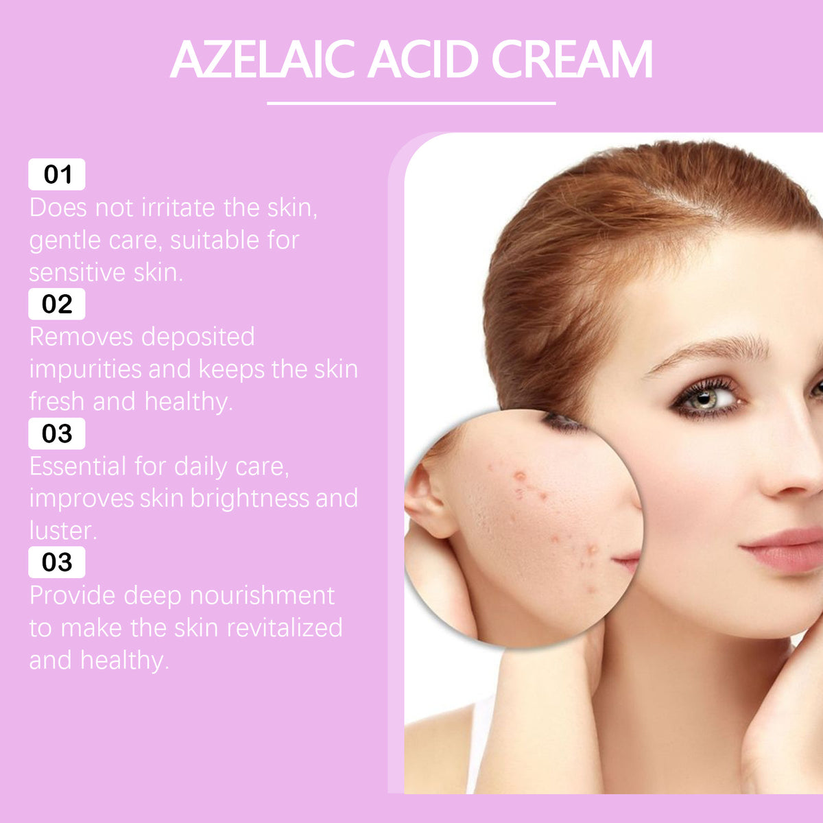 Azelaic Acid Acne Care Cream - Gentle Moisturizing Formula 20G