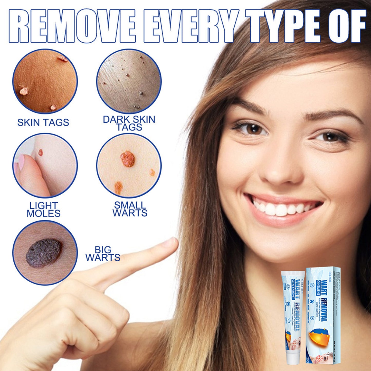 Skin Blemish and Wart Removal Cream - Natural Herbal Formula