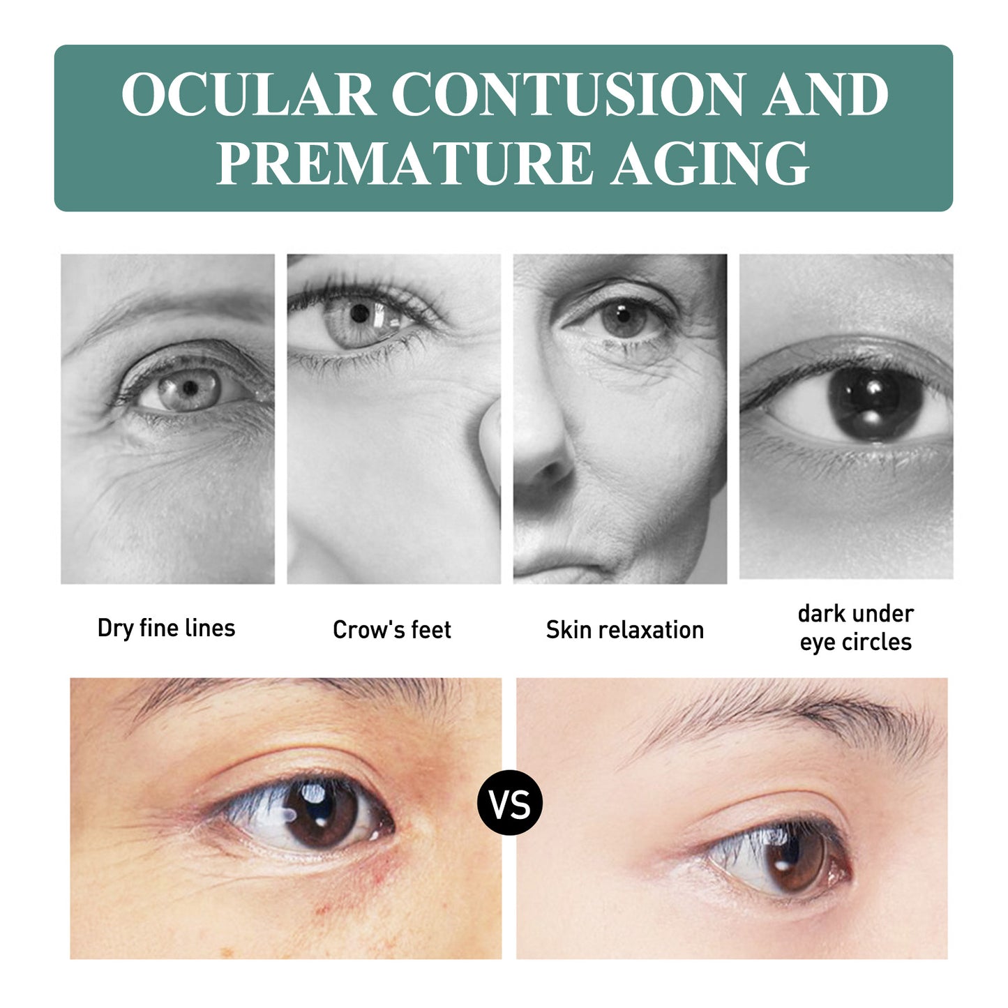 Anti-Wrinkle Eye Cream with Collagen & Hyaluronic Acid for Dark Circles