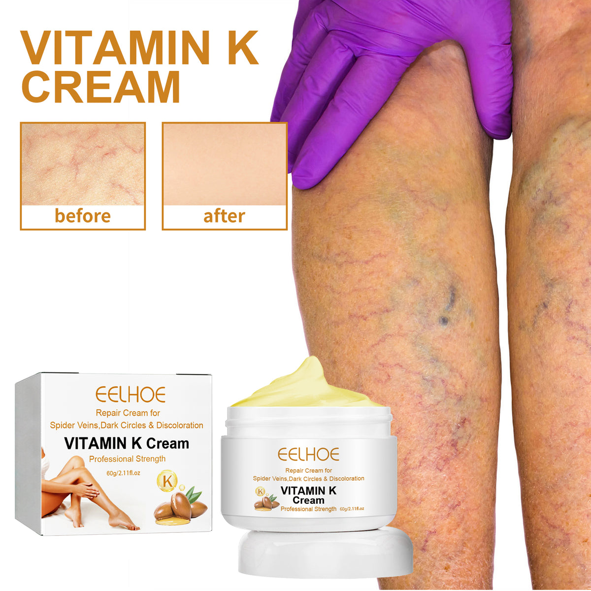 Vitamin K Cream 60g - Varicose Vein & Bruise Relief