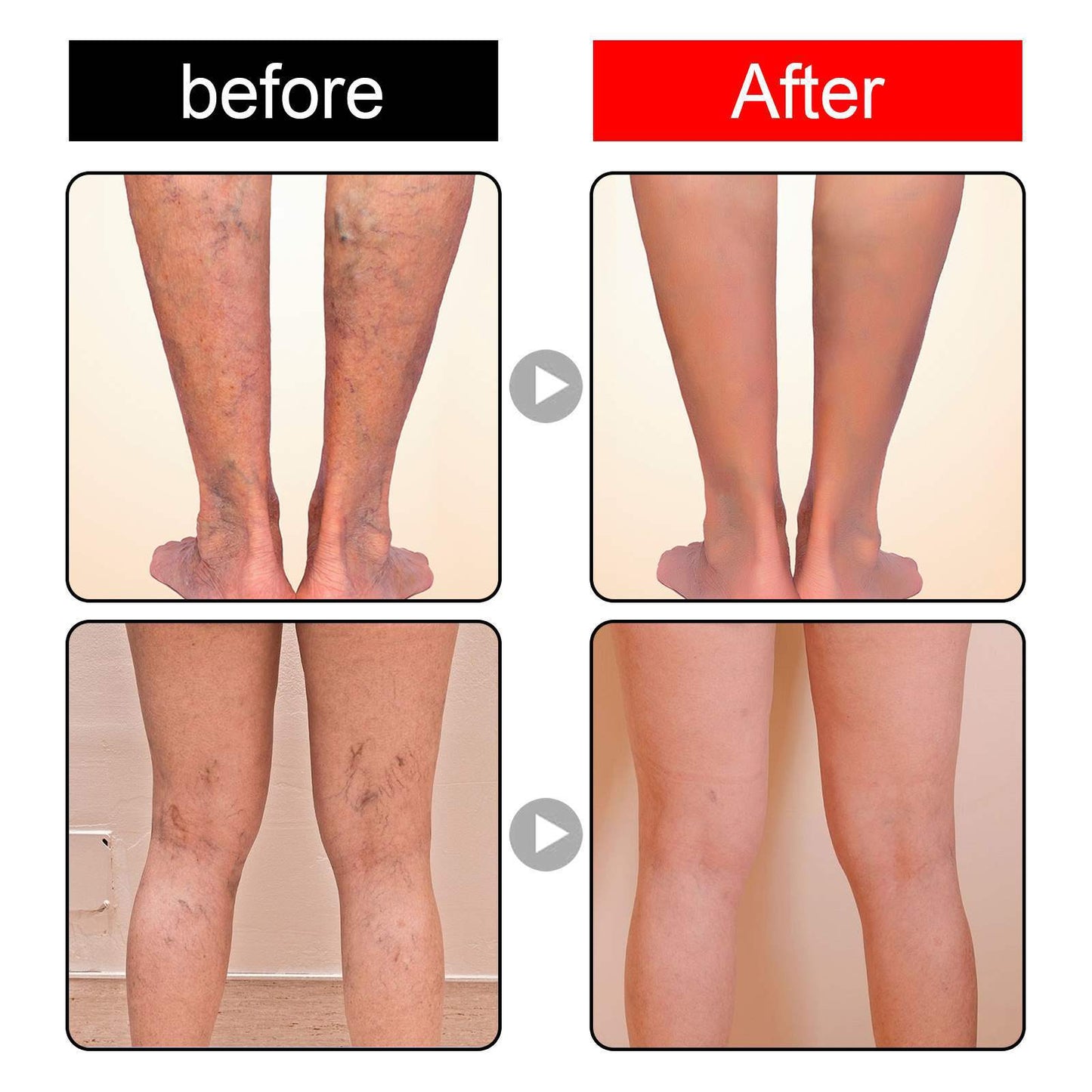 Leg Venous Support Cream for Discomfort Relief 20g - Body Care