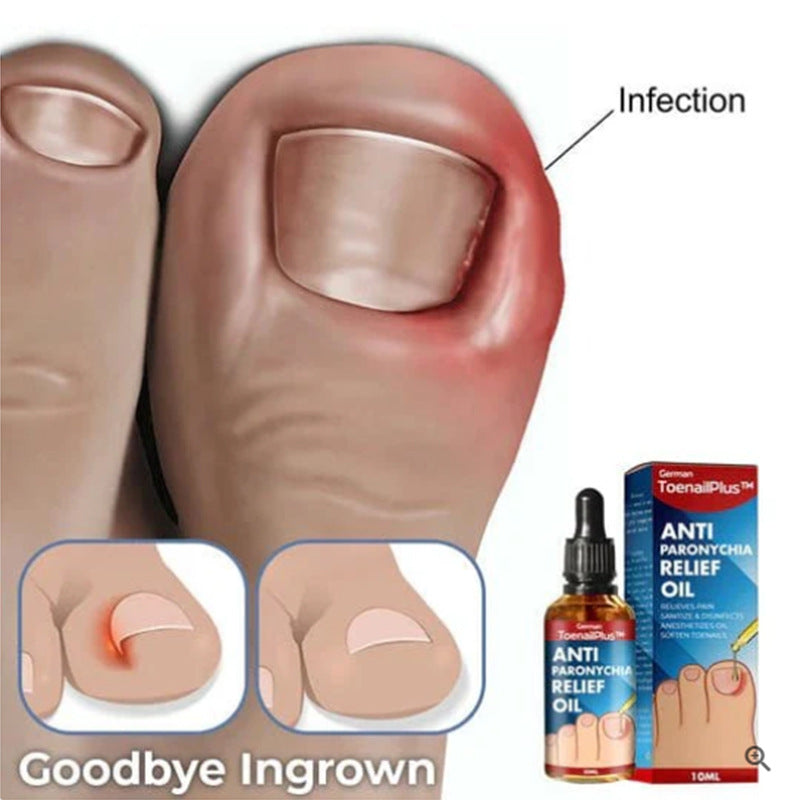 Nail Repair & Groove Treatment Oil