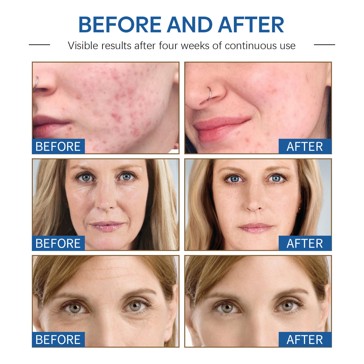 Deep Hydrating Facial Cream for Skin Brightening 50g - Moisturizing & Discoloration Repair