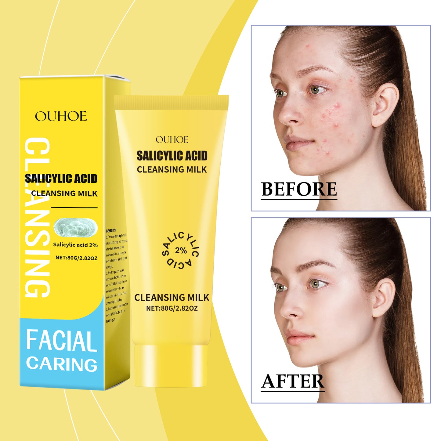 Salicylic Acid Facial Cleanser - Oil Control & Moisturizing Face Wash