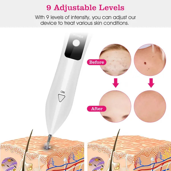 Portable Skin Tag Repair Kit - 9-Level Adjustable Electric Mole Remover