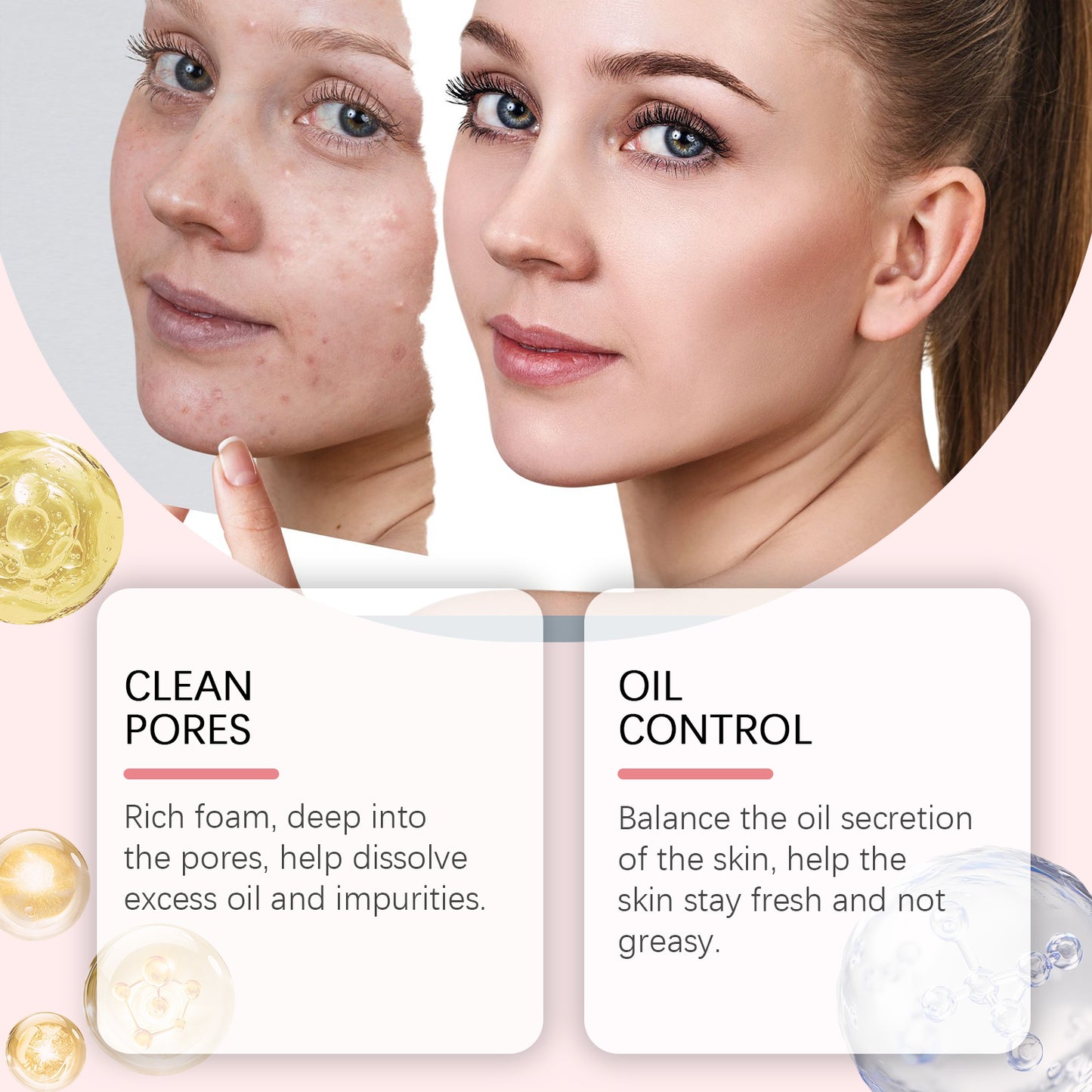 Salicylic Acid Foam Cleanser - Deep Pore Cleansing & Oil Control 100ml