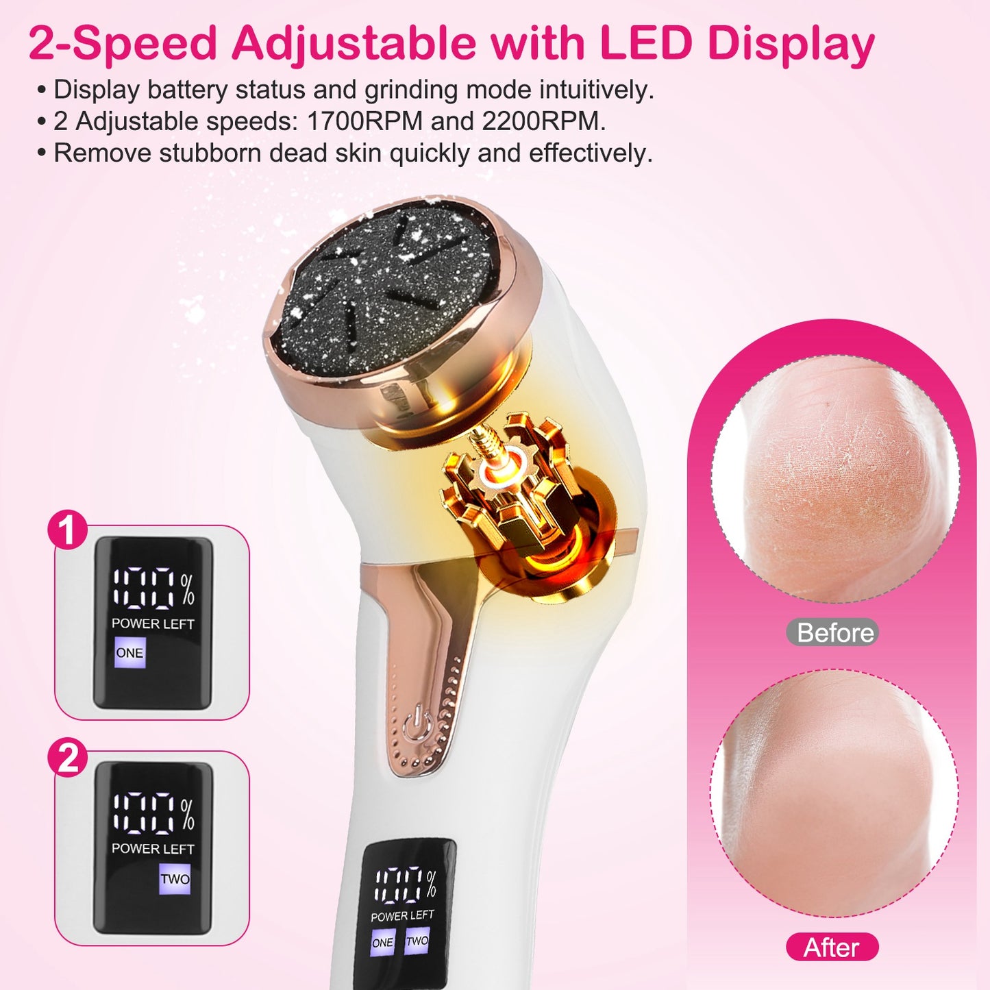 17-Piece Electric Foot Callus Remover with Vacuum and 3 Grinding Heads