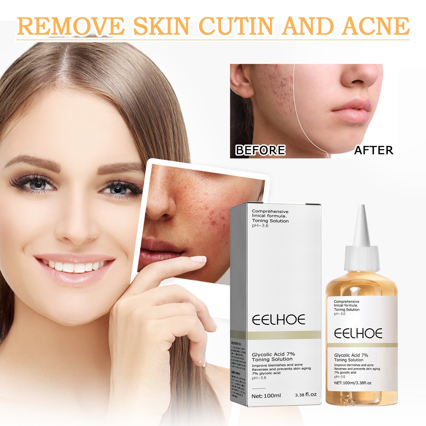 Glycolic Acid 7% Facial Lotion for Acne, 100ml - Moisturizing & Exfoliating