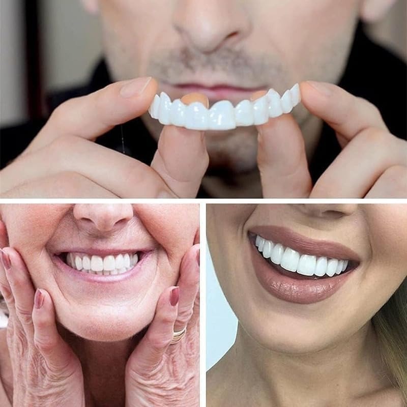 Comfortable Silicone Cosmetic Veneers for Dentures - White