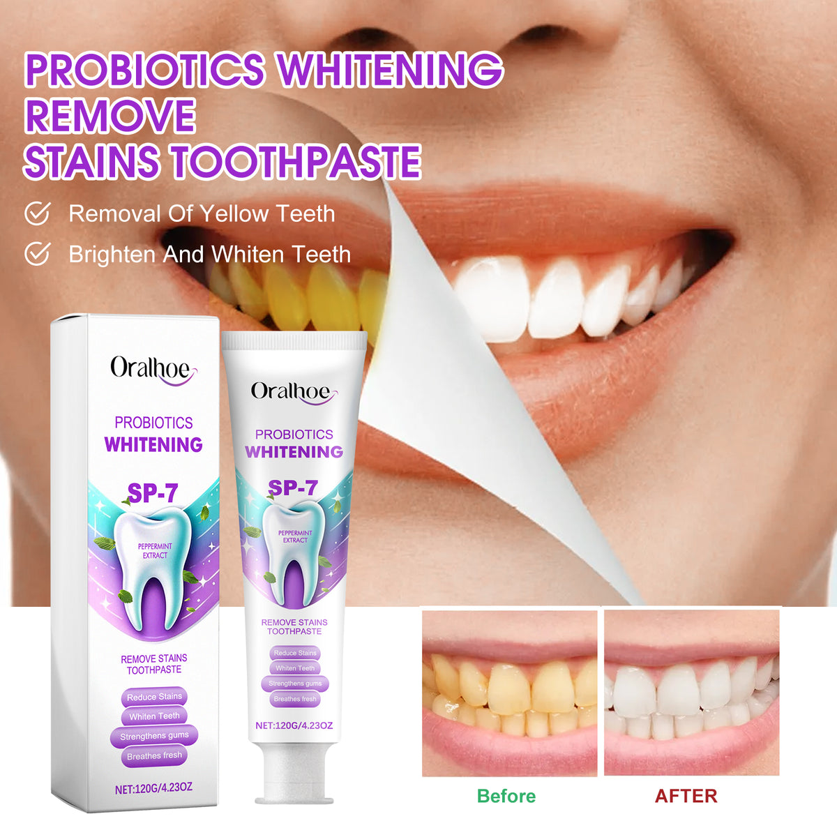 Probiotic Whitening Toothpaste 120g - Dental Care for Stain Removal & Fresh Breath
