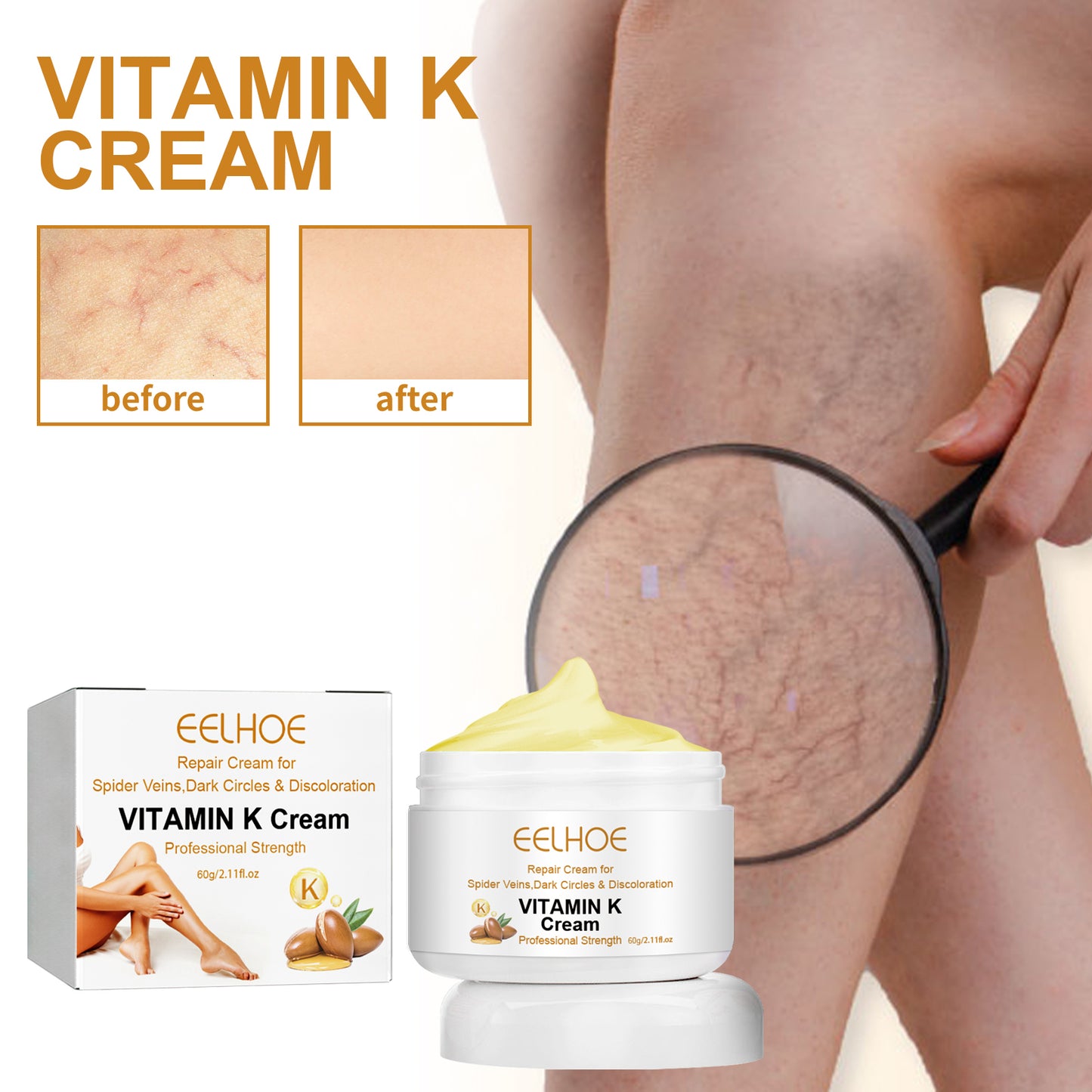 Vitamin K Cream for Varicose Veins and Bruise Relief - Soothing Leg Care