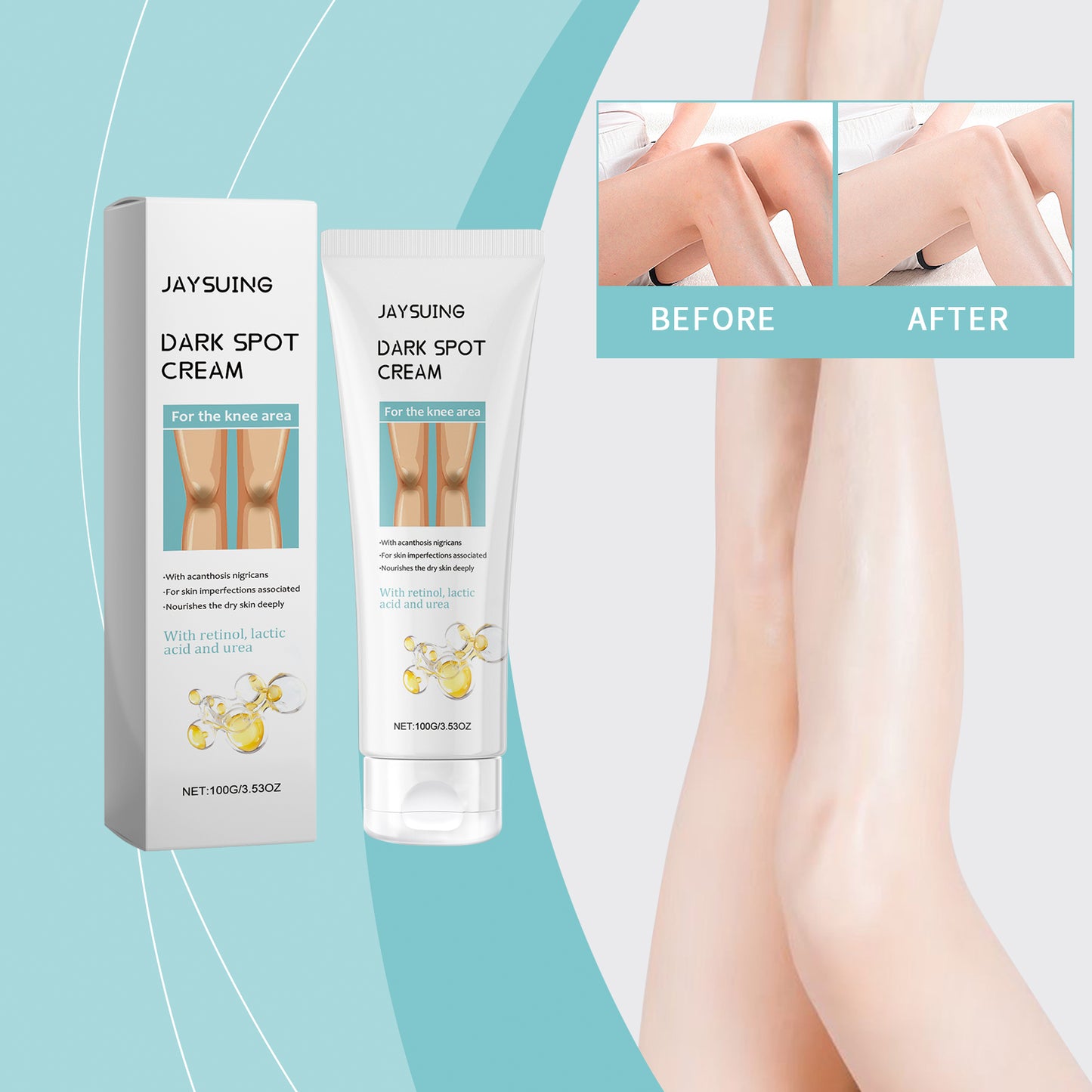 Knee Whitening Cream - Moisturizing & Hydrating Skin Care for Knees