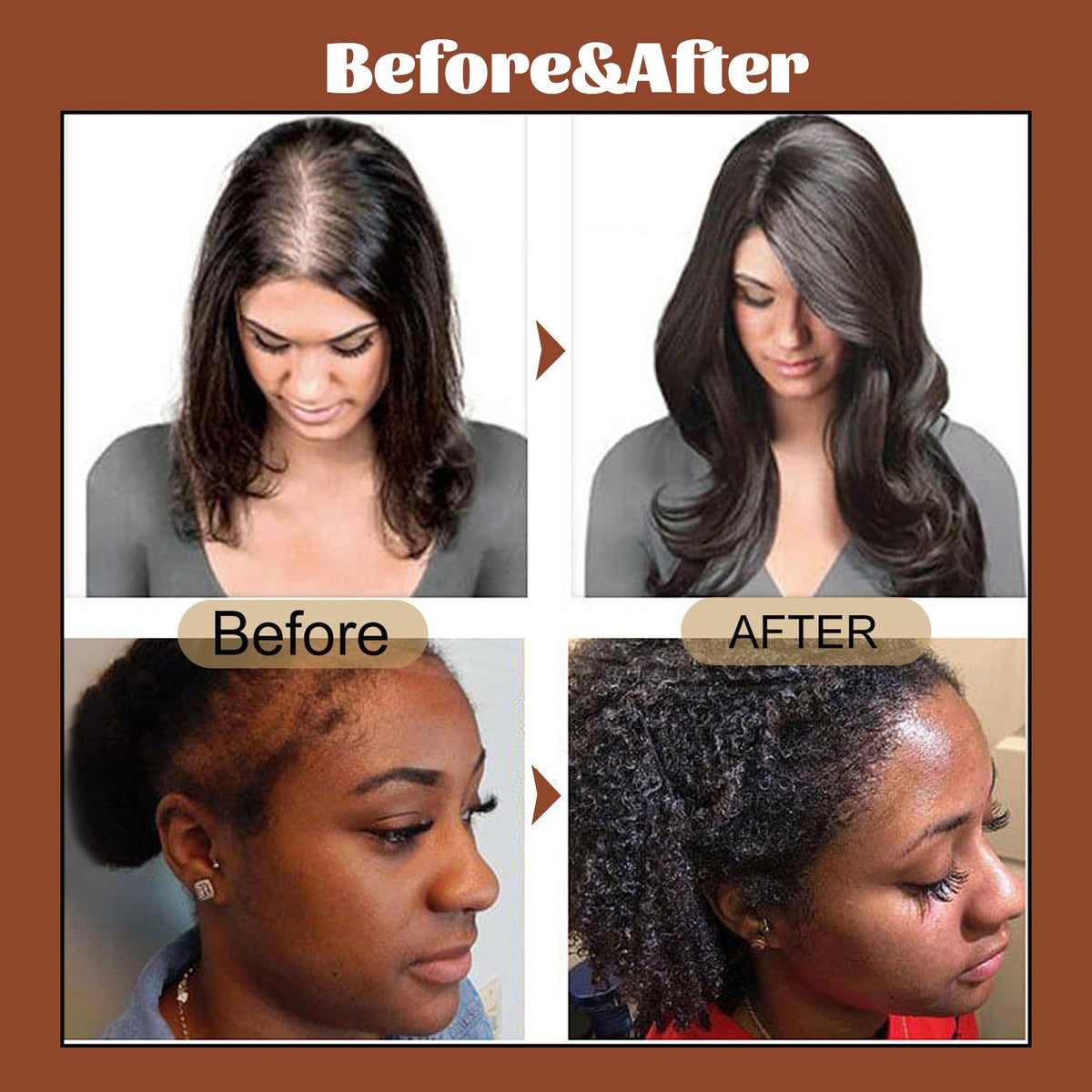 Promote Hair Growth And Care With Oil