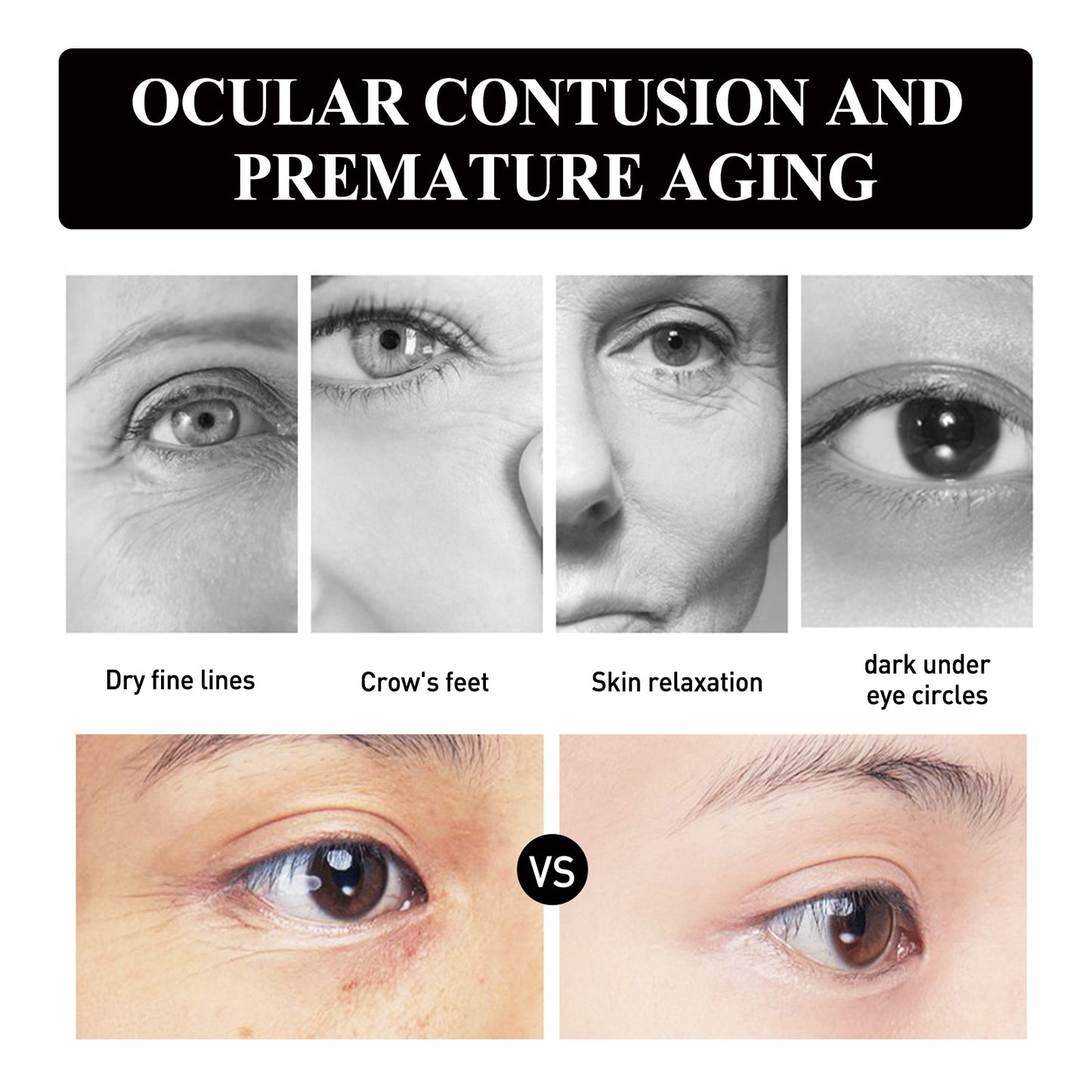 Strawberry Collagen Eye Gel Patches - Anti-Aging & Dark Circle Treatment
