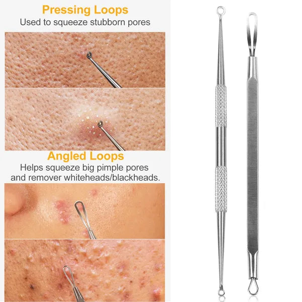 5-Piece Blackhead Remover Kit - Professional Pimple Extractor Tool Set