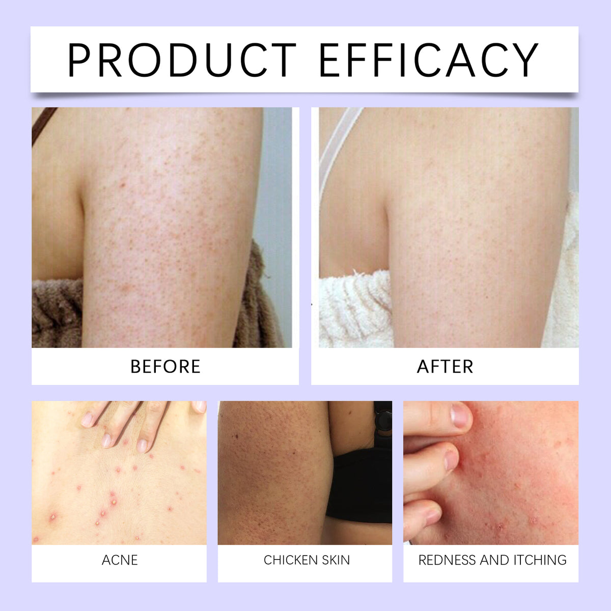 Skin Soothing Cream 20g Box