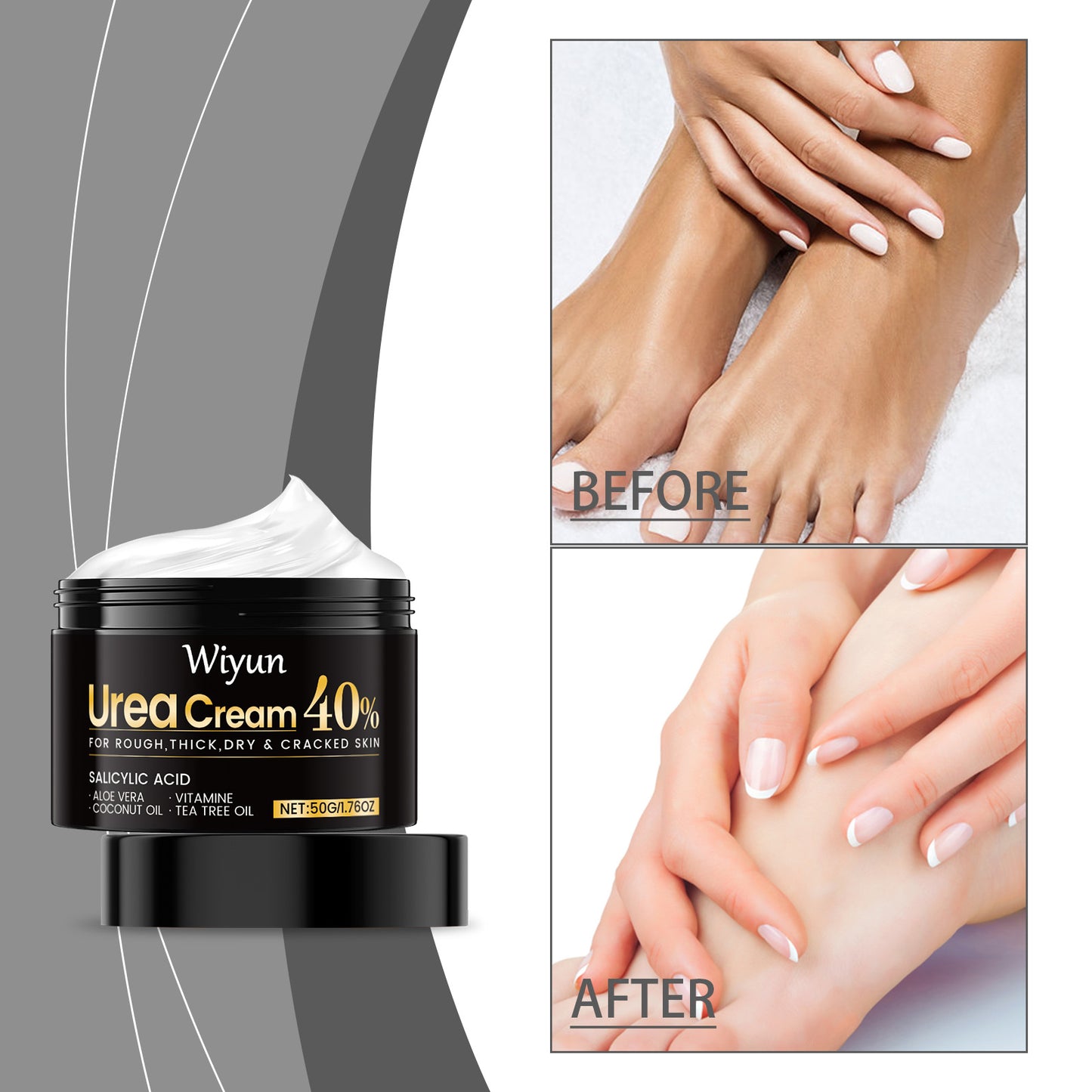 Hand and Foot Care Urea Cream 50g Moisturizing Nourishing Skin Care