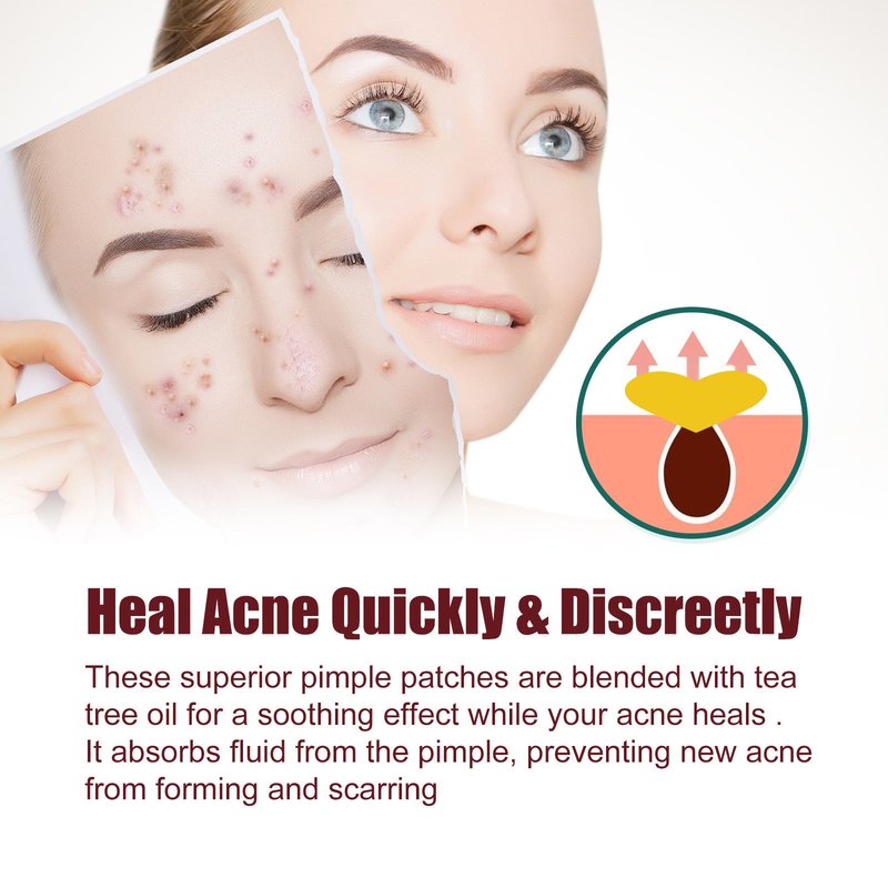 Facial Care Acne Patch Stickers - 200 Pieces, Hydrocool & Soothing