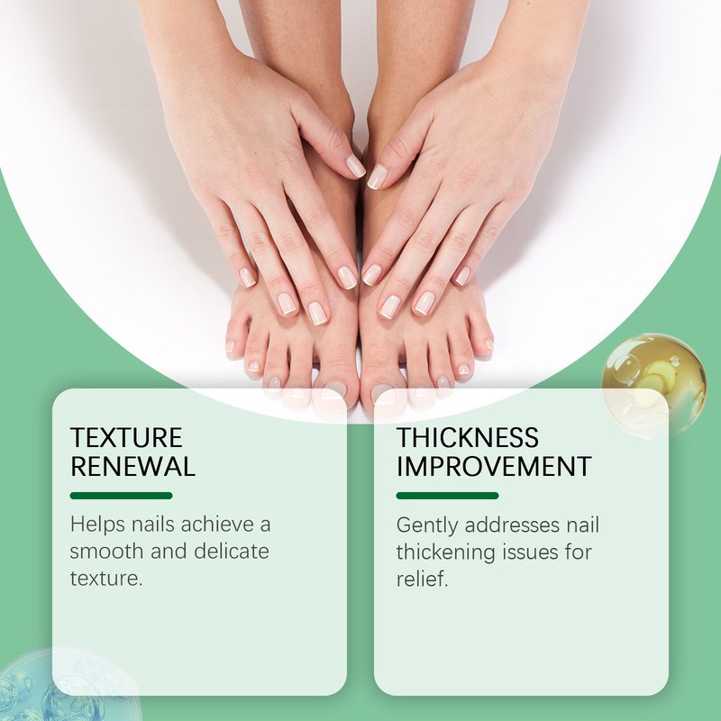 Moisturizing Cuticle Care Solution - 30ml Nail & Skin Treatment