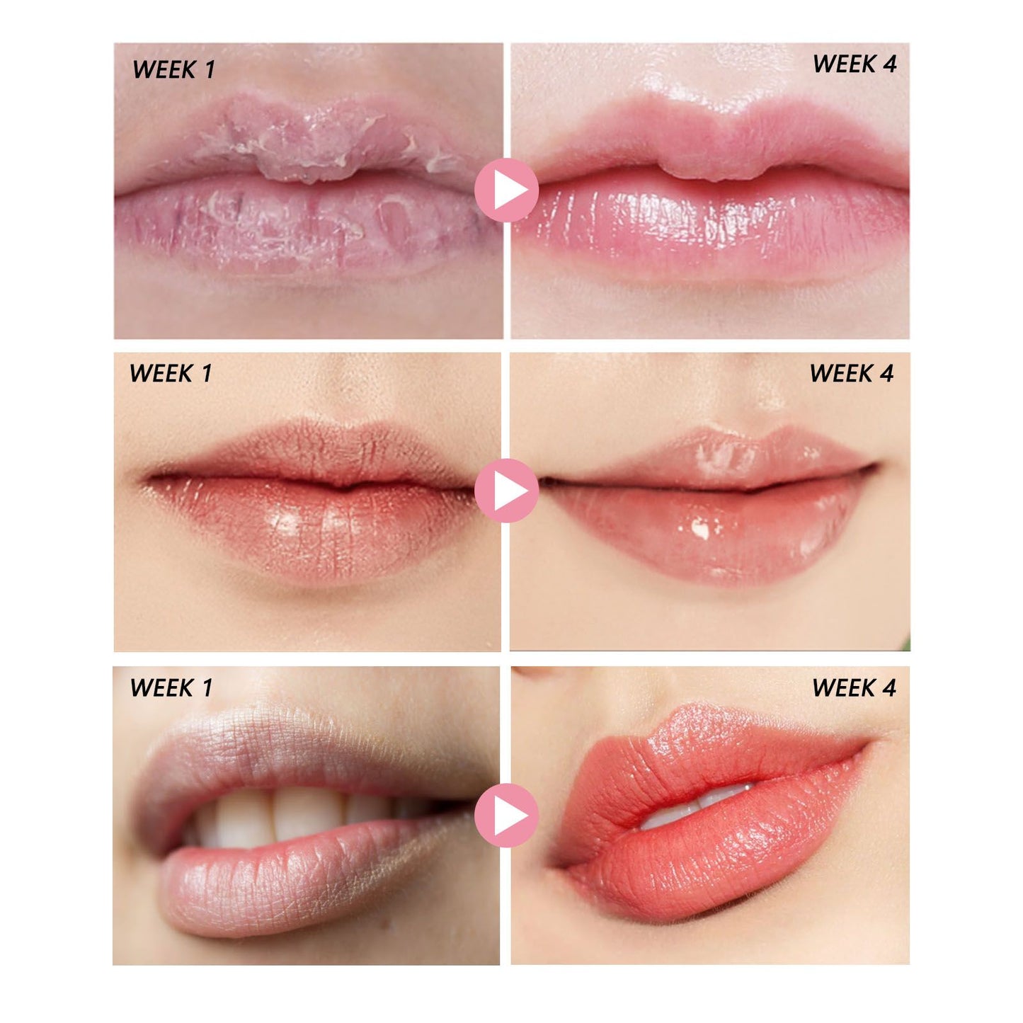 Peach Lip Scrub for Exfoliation and Hydration - Natural Lip Care