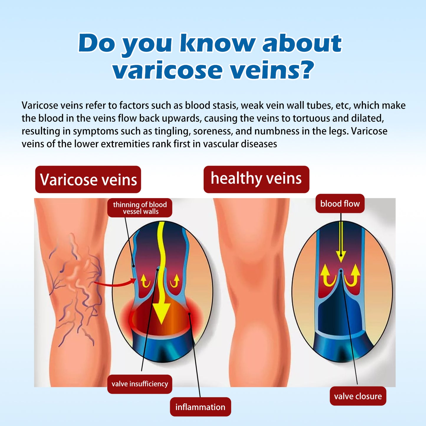 Varicose Vein Relief & Slimming Cream - Leg Vein Repair & Body Care