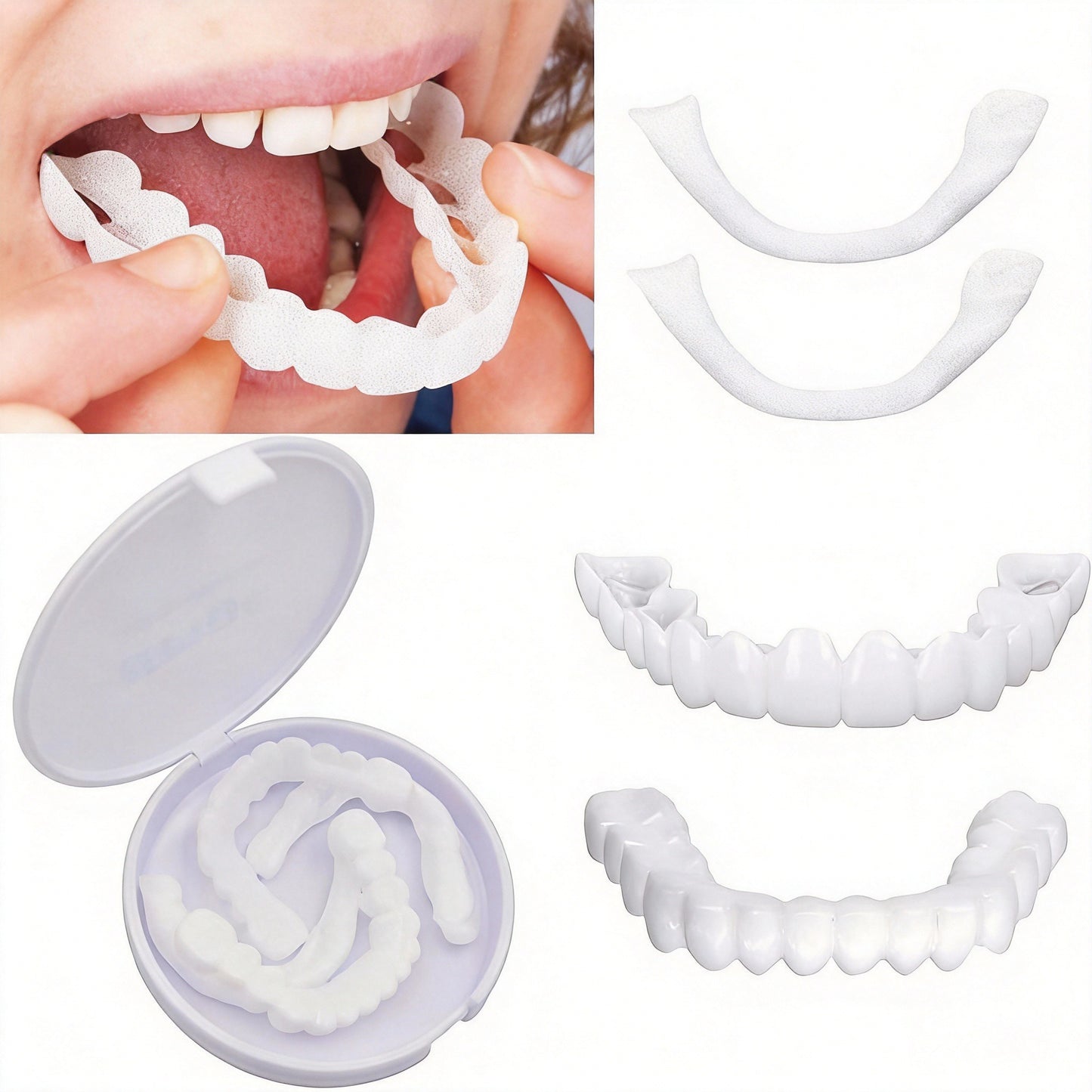 Comfortable Silicone Cosmetic Veneers for Dentures - White