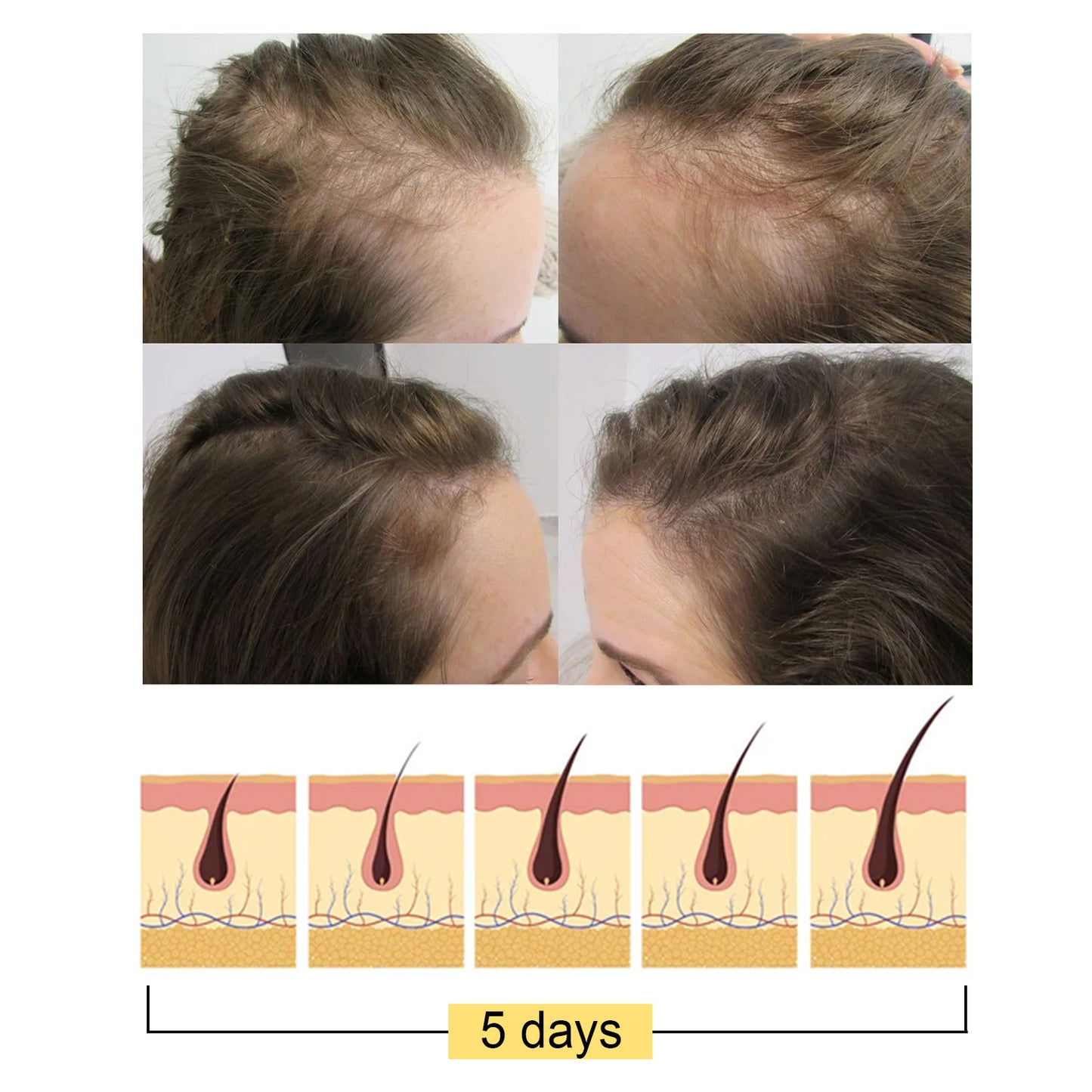 Rice Shampoo Bar for Hair Growth and Nourishing Scalp Repair
