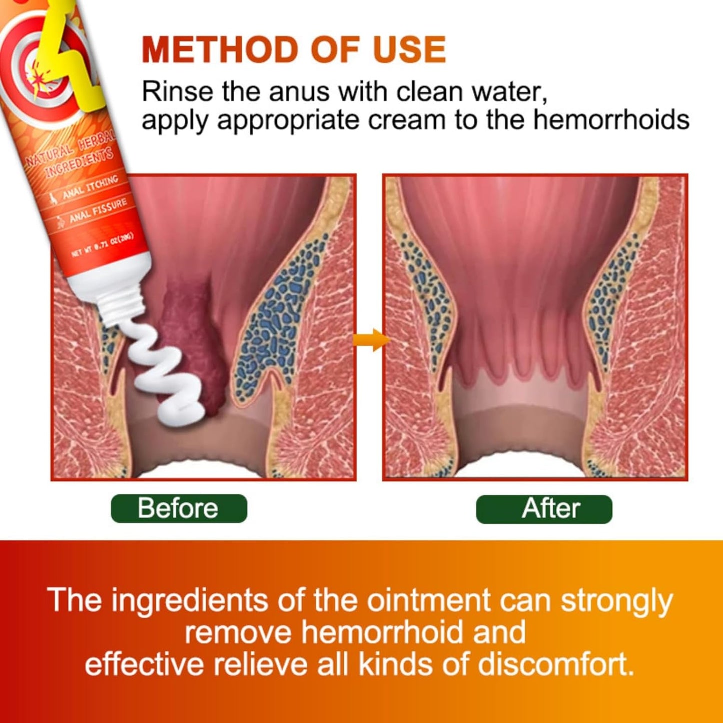 Natural Herbal Hemorrhoid Relief Cream - 20g Soothing Ointment
