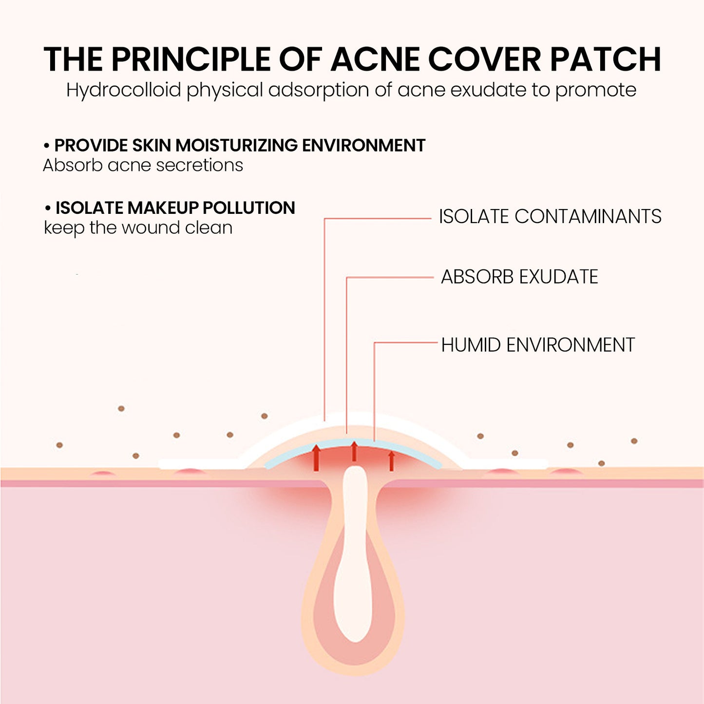 Hydrocolloid Acne Patches - 200 Count Invisible Blemish Spot Treatment