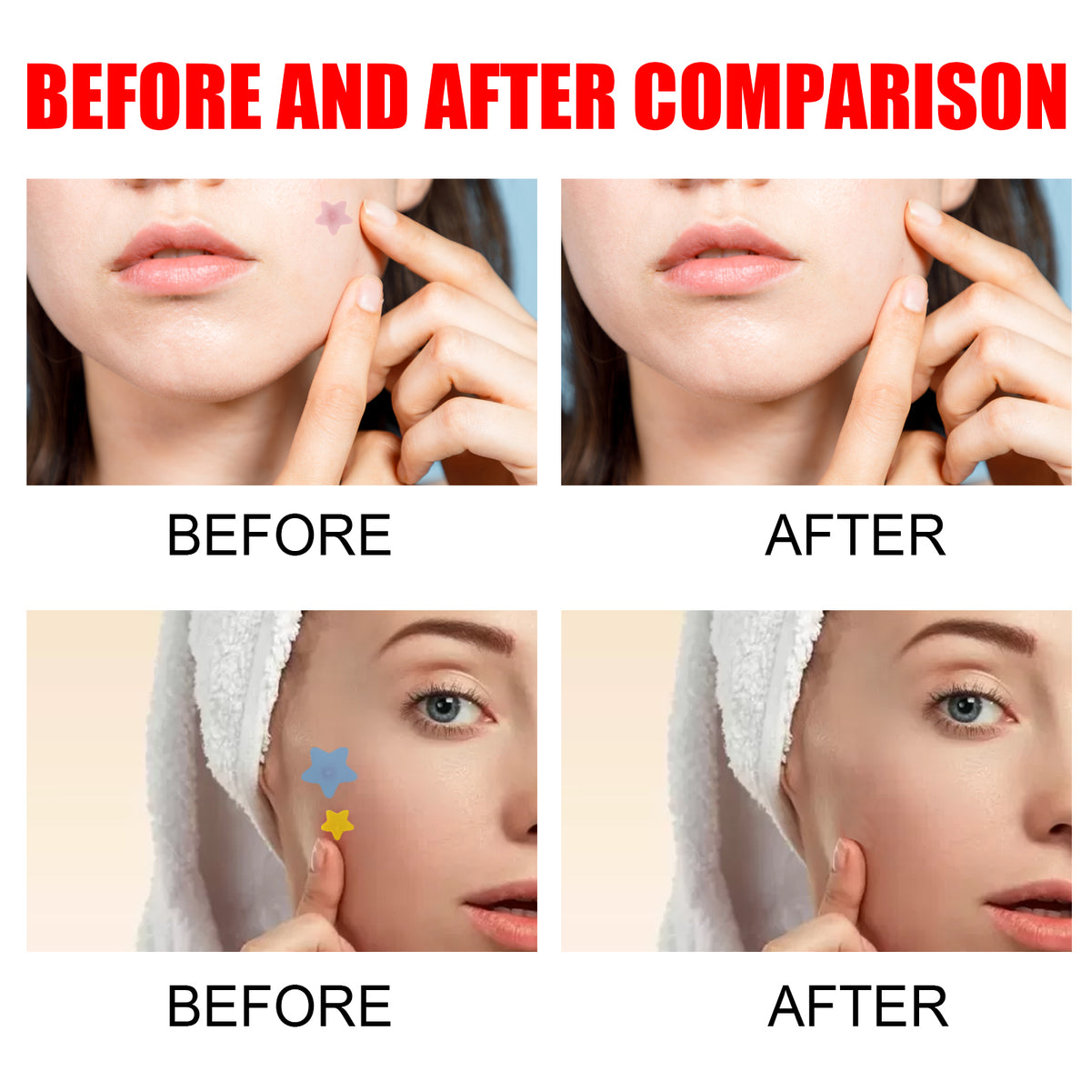 Clean Face Stickers 40 X 5 Sheets, 200pcs 1box