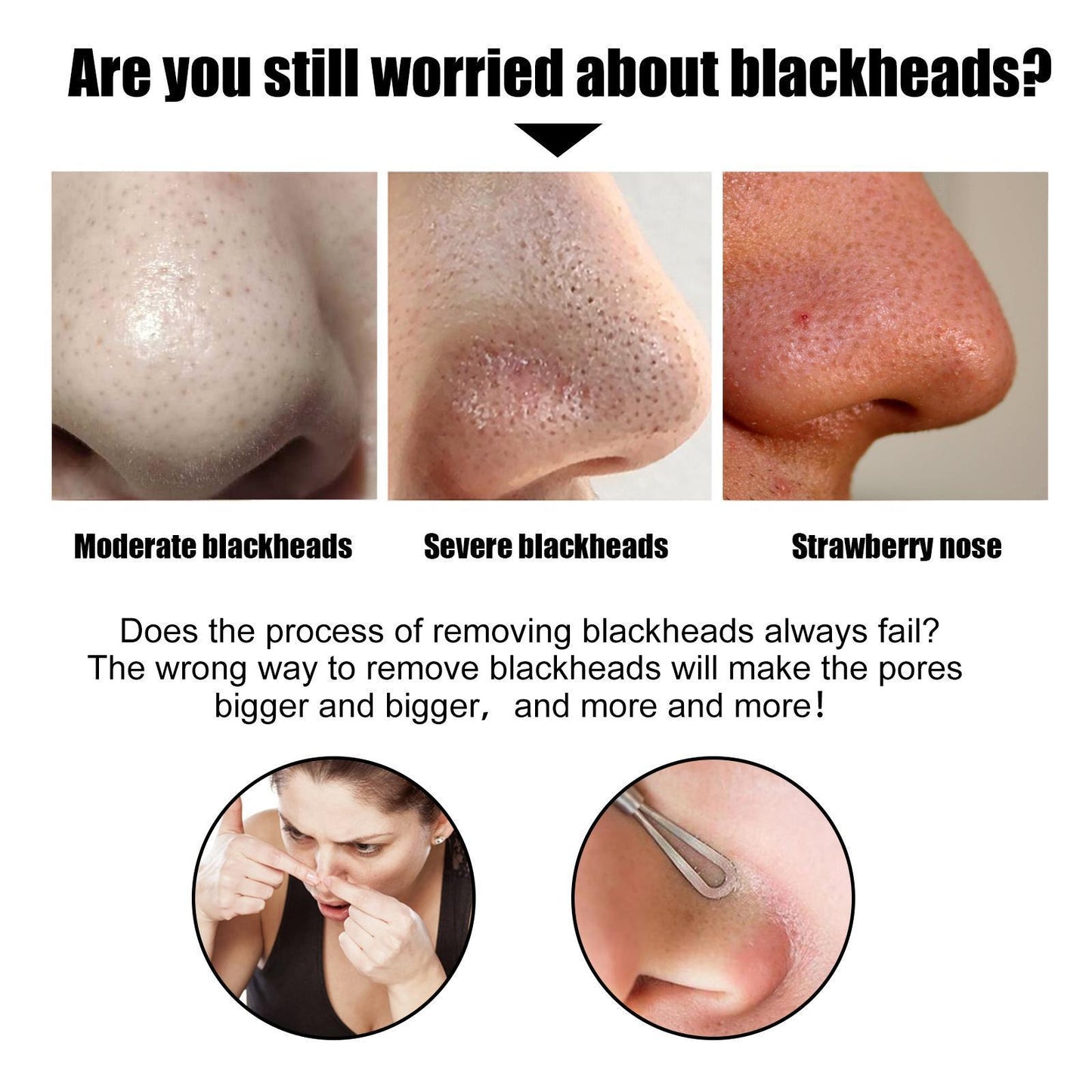 10 Pcs Blackhead Remover Nose Strips - Deep Pore Cleansing & Oil Control