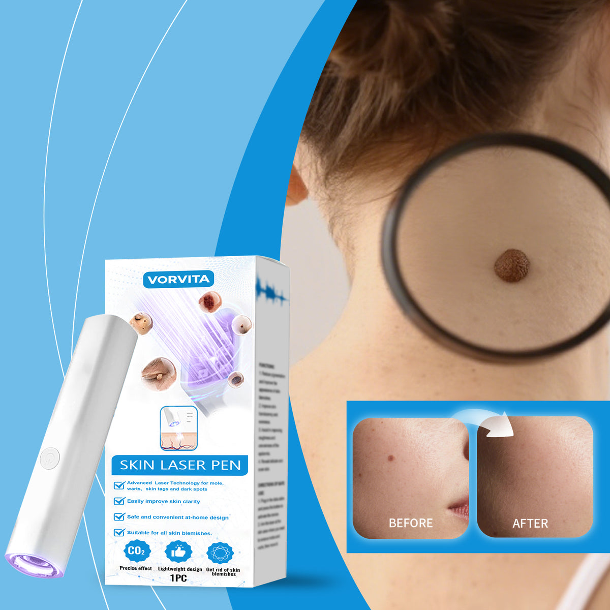 Skin Laser Pen Body Care Tool