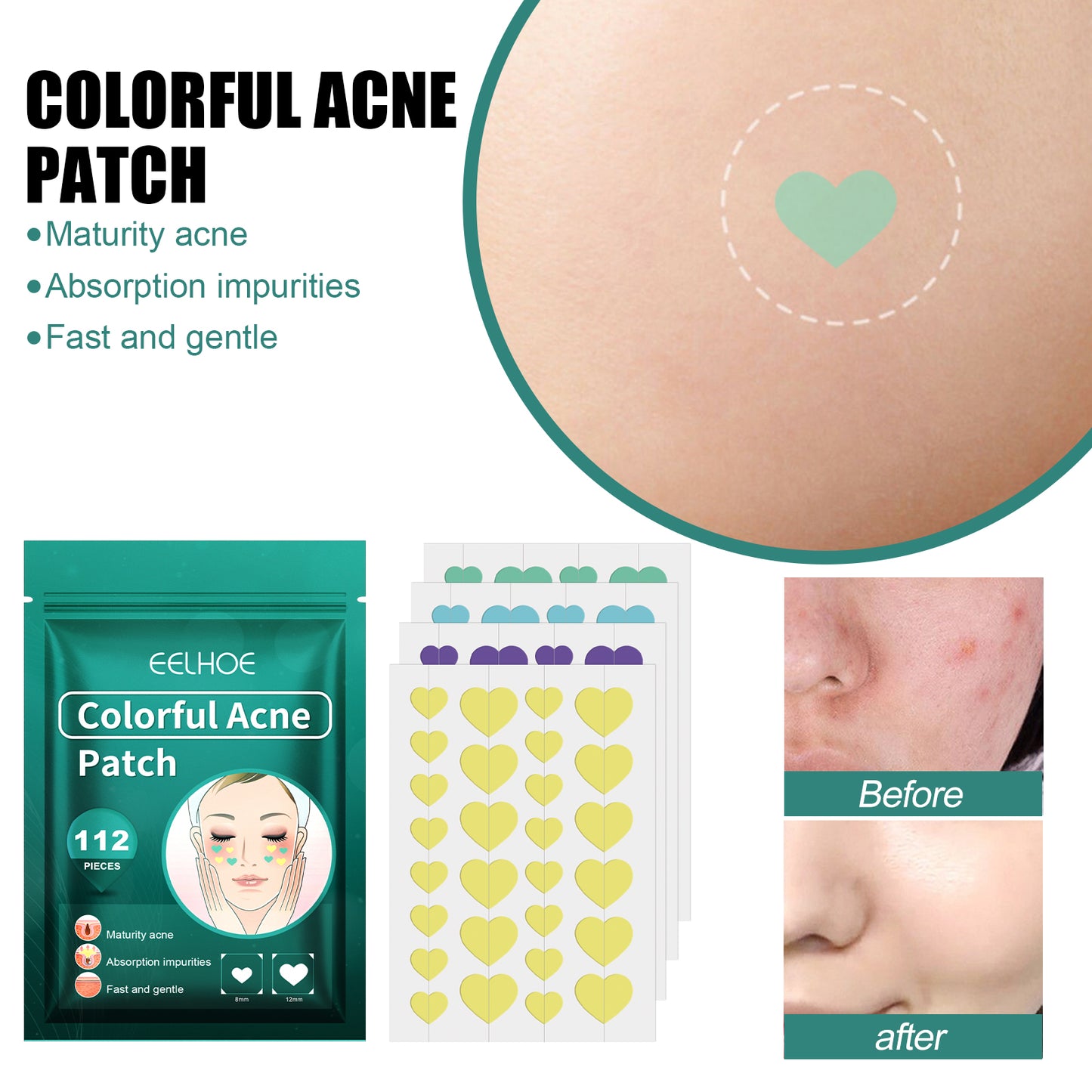Heart-Shaped Acne Patches with Tea Tree Oil & Hyaluronic Acid