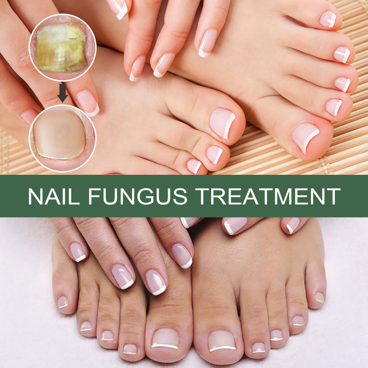 Nail Care Liquid for Cleaning Fingernails and Toenails - 30ml & 50ml Options