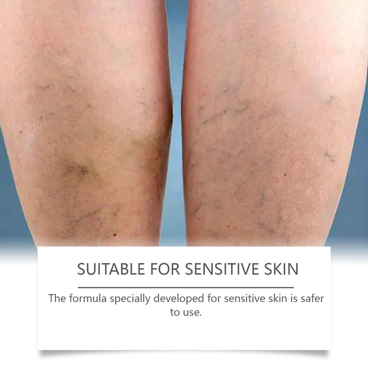 Gentle Care And Massage Of The Legs To Relieve Discomfort, Nourish