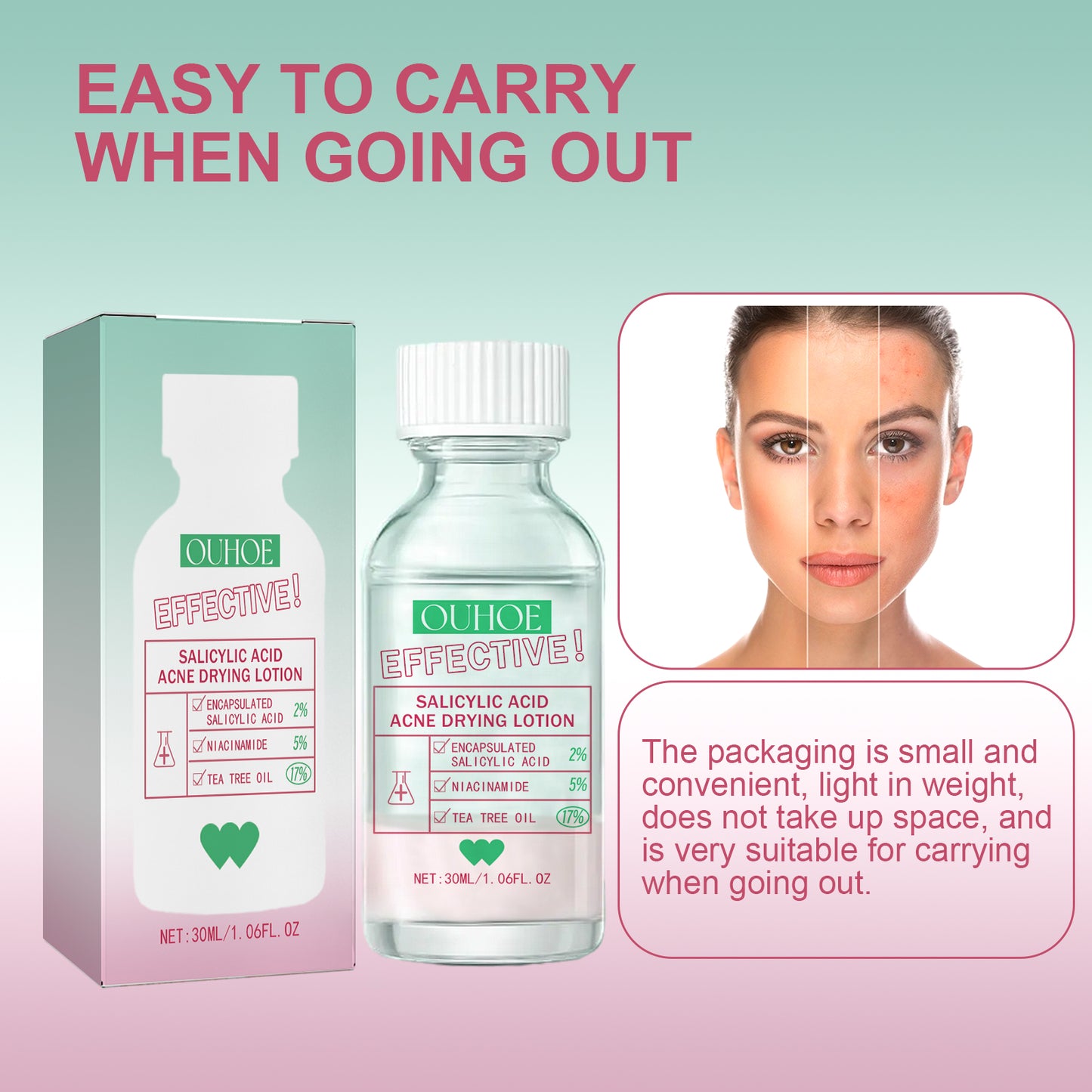 Salicylic Acid Acne Treatment Lotion - Pore Refining & Moisturizing Face Care